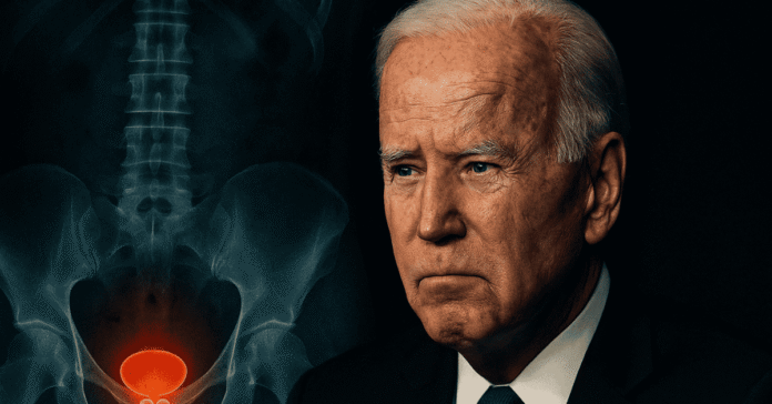 Joe Biden Prostate Cancer